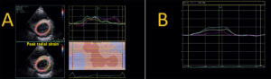 Figure 8.3