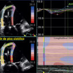 Figura 13.3