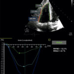 Figure 13.4