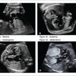Figura 1