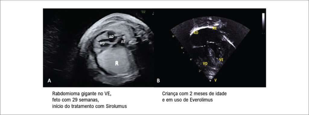 Figura 3