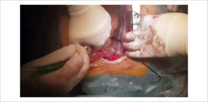 Video 3