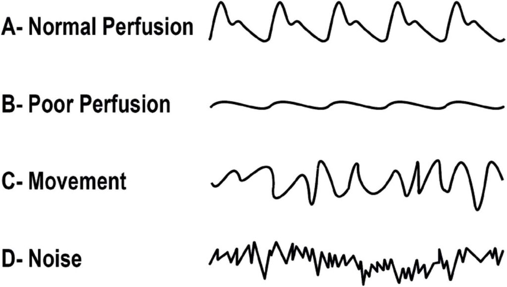 Figure 16