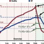 Figure 32