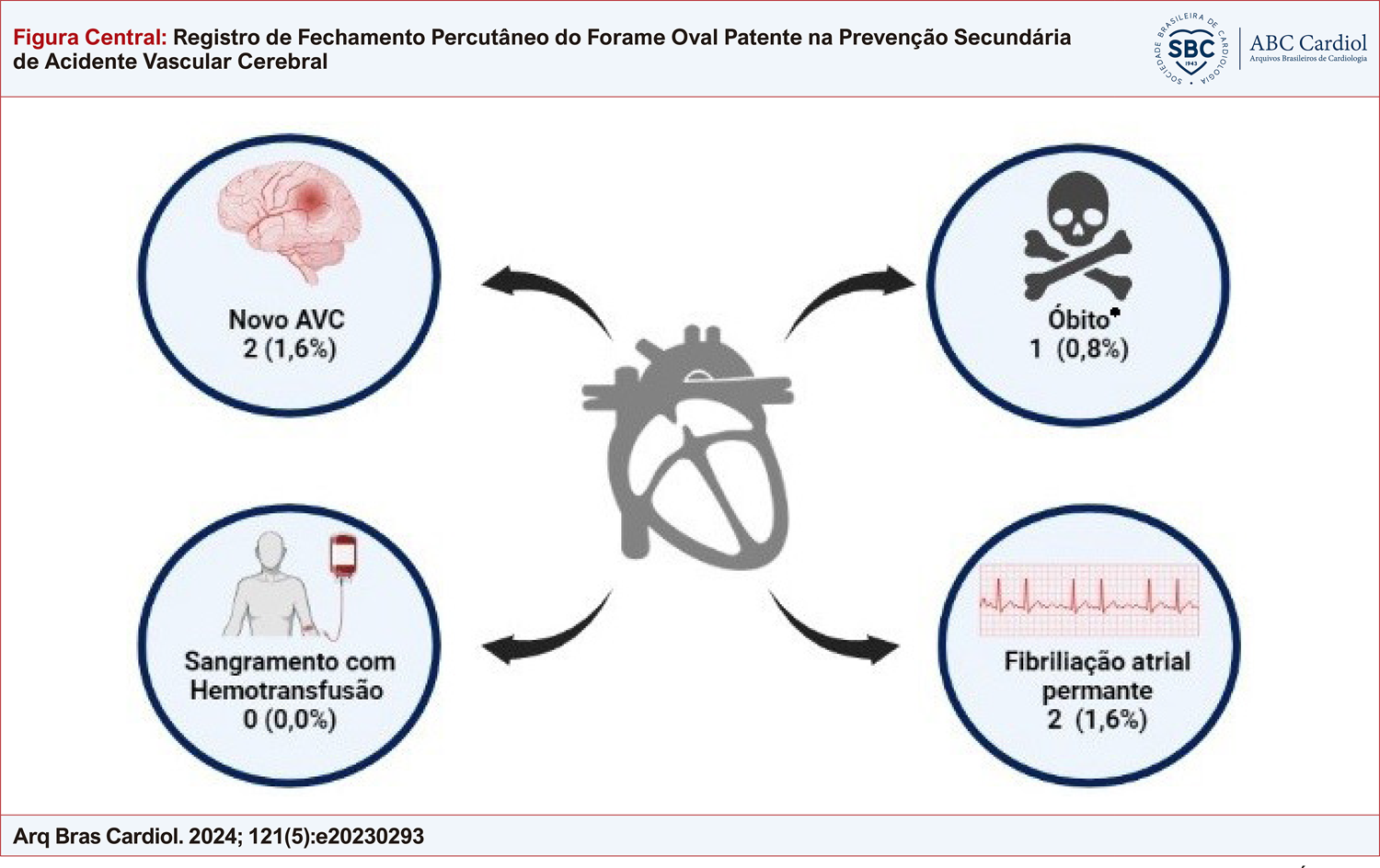 Registro de Fechamento Percutâneo do Forame Oval Patente na Prevenção Secundária de Acidente Vascular Cerebral