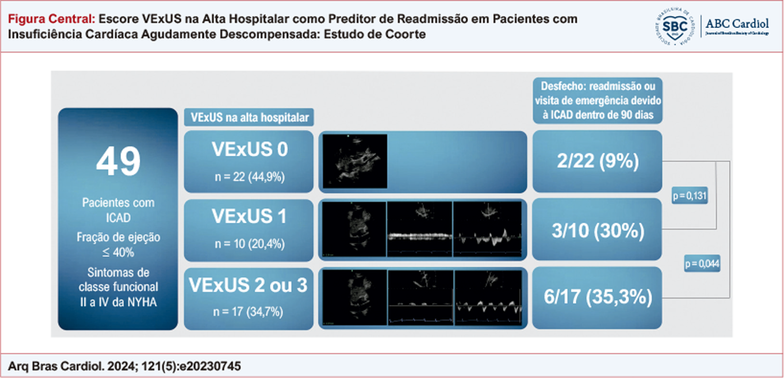 Escore VExUS na Alta Hospitalar como Preditor de Readmissão em Pacientes com Insuficiência Cardíaca Agudamente Descompensada: Estudo de Coorte