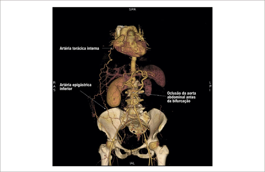 Figura 1
