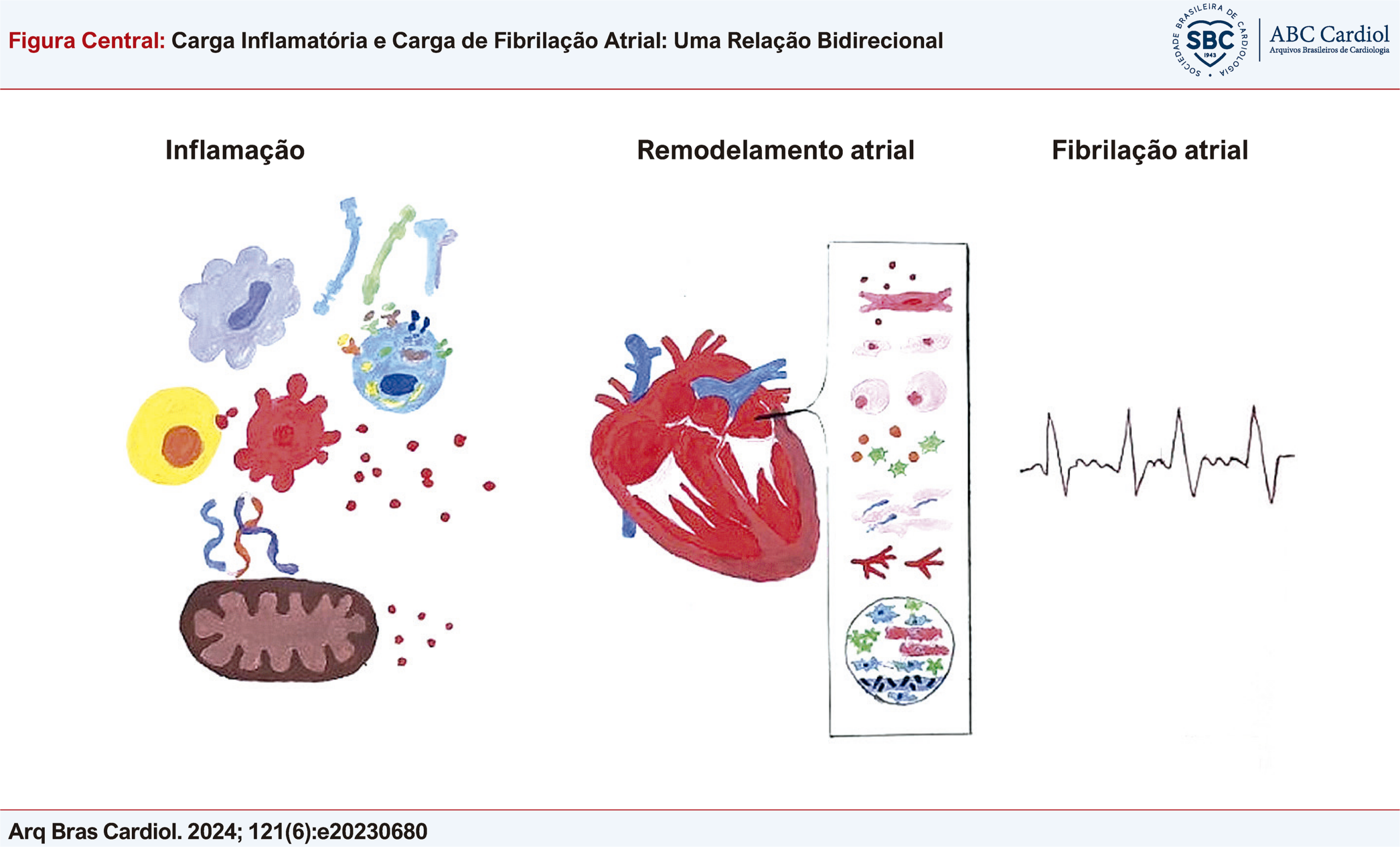 Carga Inflamatória e Carga de Fibrilação Atrial: Uma Relação Bidirecional