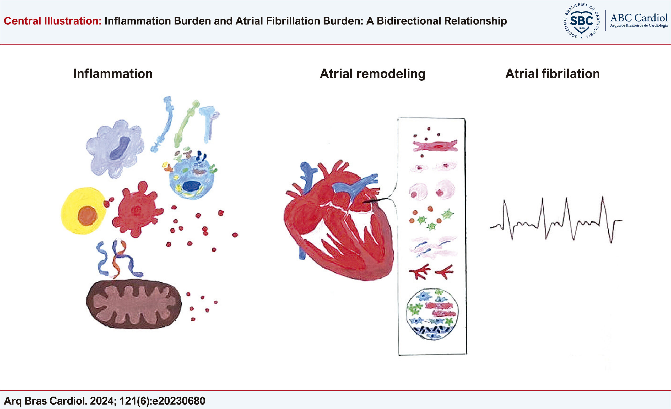 Inflammation Burden and Atrial Fibrillation Burden: A Bidirectional Relationship