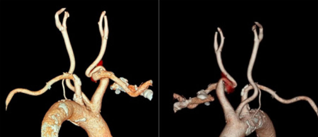 Figura 2