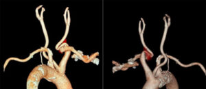 Figura 2