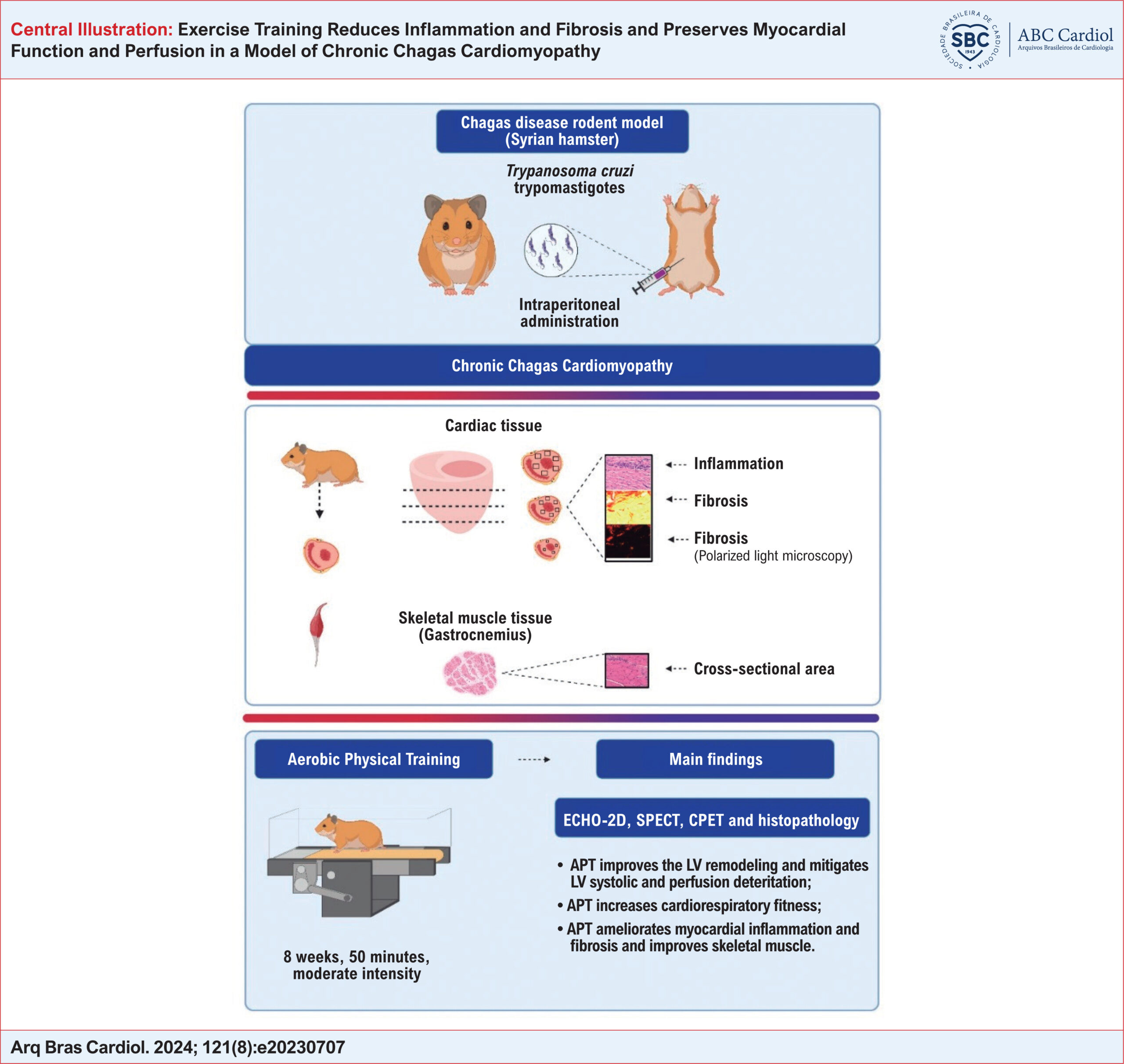 Exercise Training Reduces Inflammation and Fibrosis and Preserves Myocardial Function and Perfusion in a Model of Chronic Chagas Cardiomyopathy