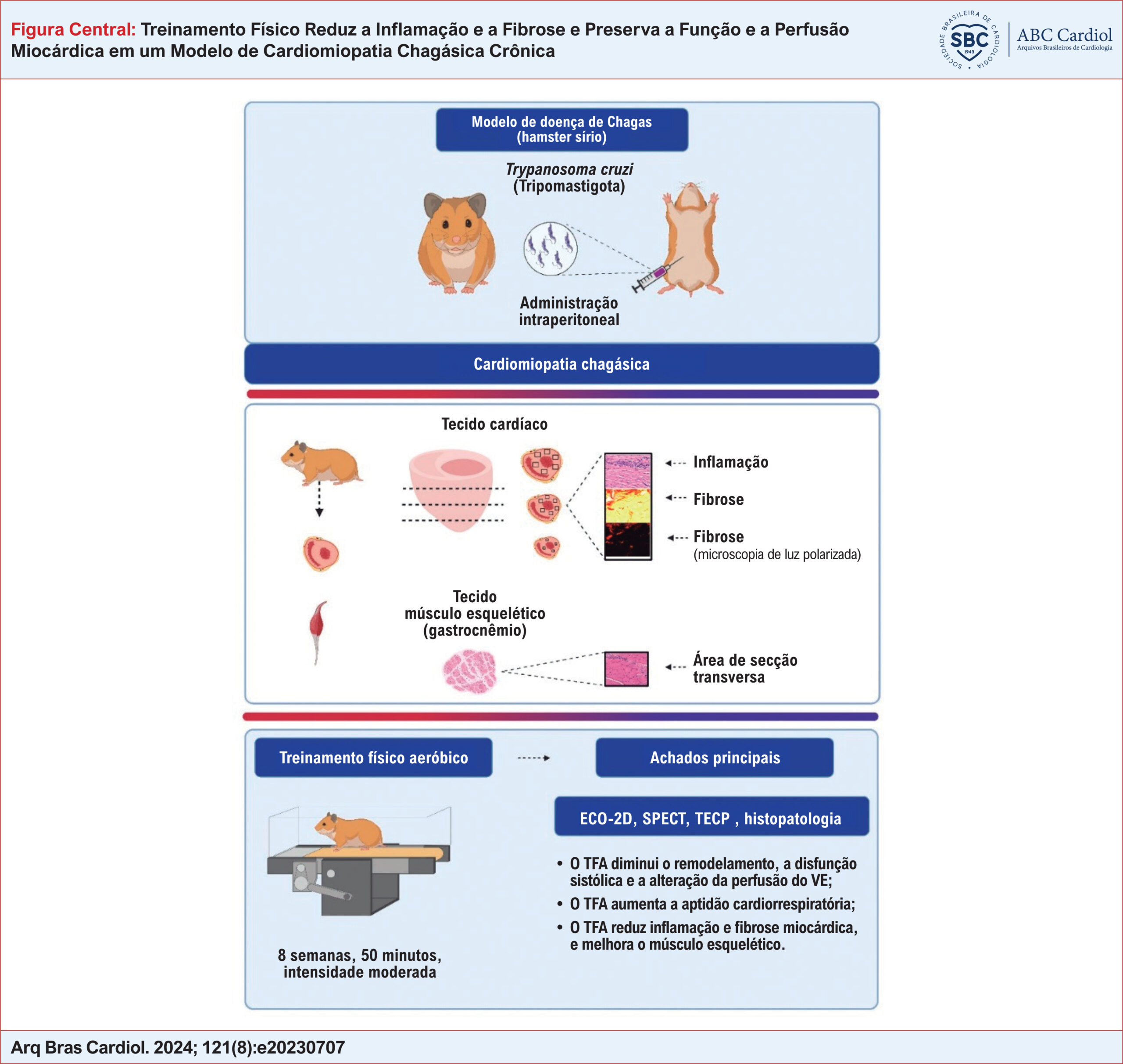 Treinamento Físico Reduz a Inflamação e a Fibrose e Preserva a Função e a Perfusão Miocárdica em um Modelo de Cardiomiopatia Chagásica Crônica