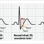 Figura 4