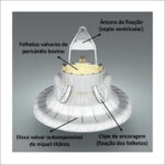 Figura 1