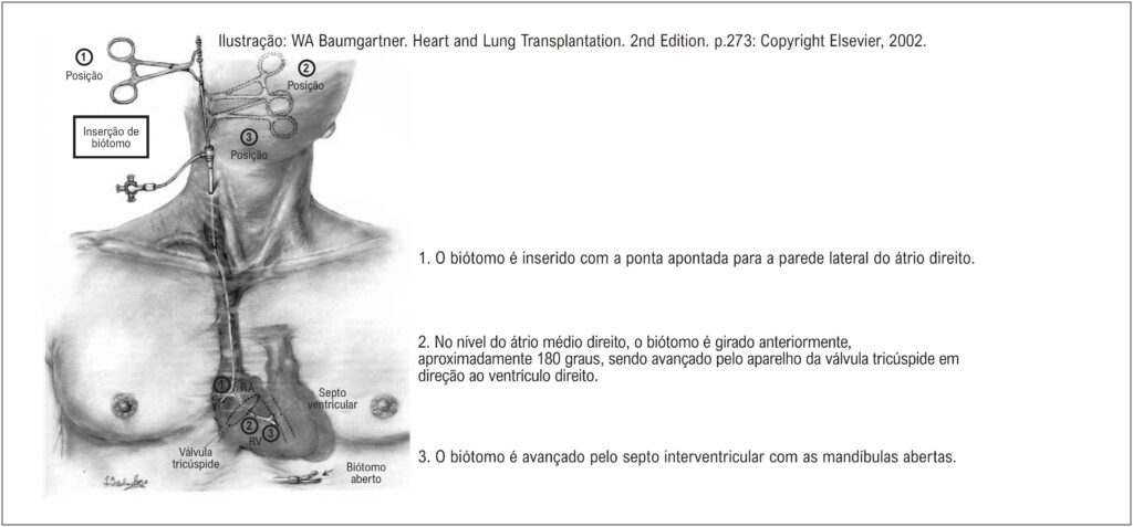 Figura 2