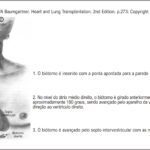 Figura 2