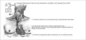 Figura 2