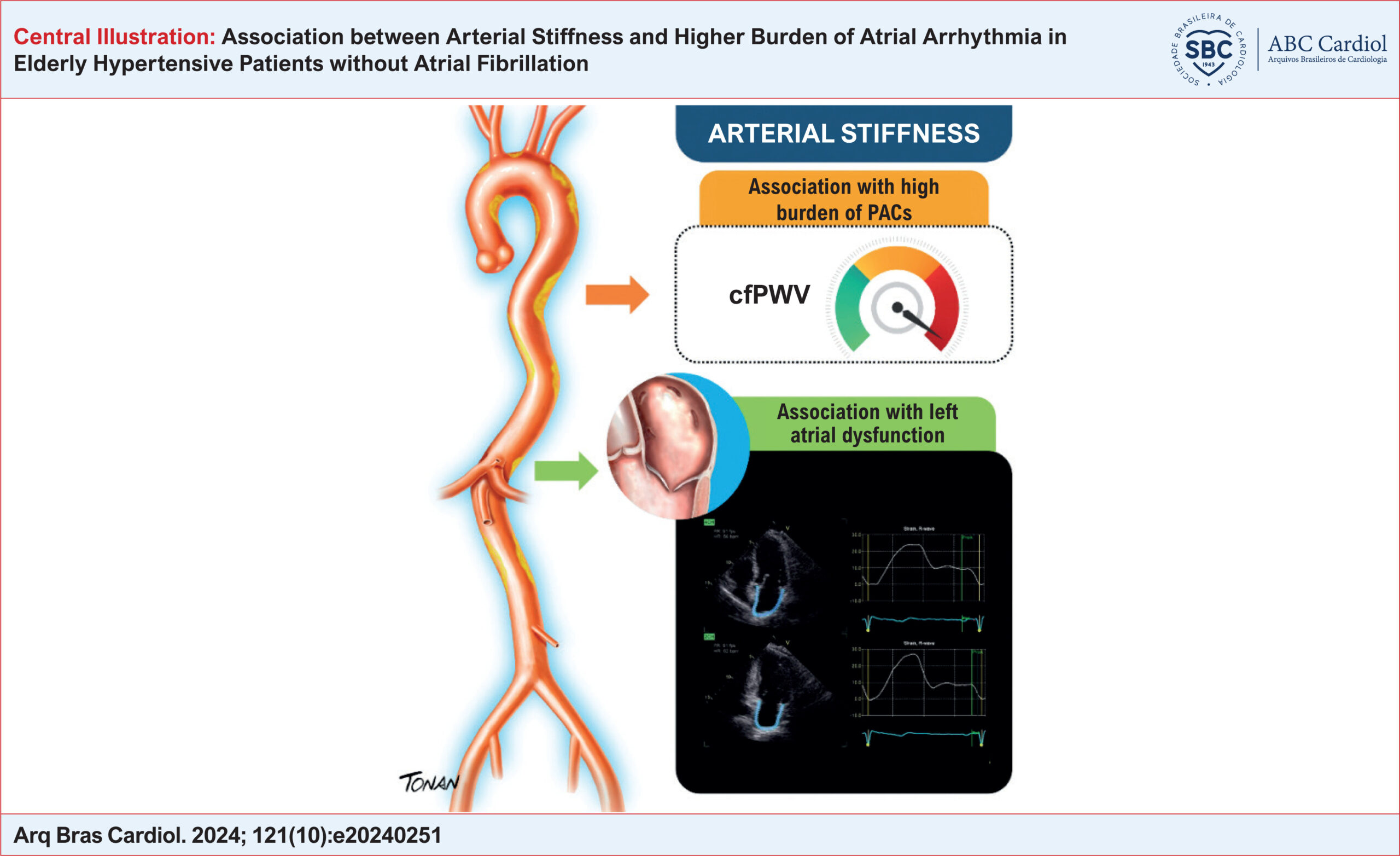 Association between Arterial Stiffness and Higher Burden of Atrial Arrhythmia in Elderly Hypertensive Patients without Atrial Fibrillation