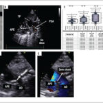 Figura 4