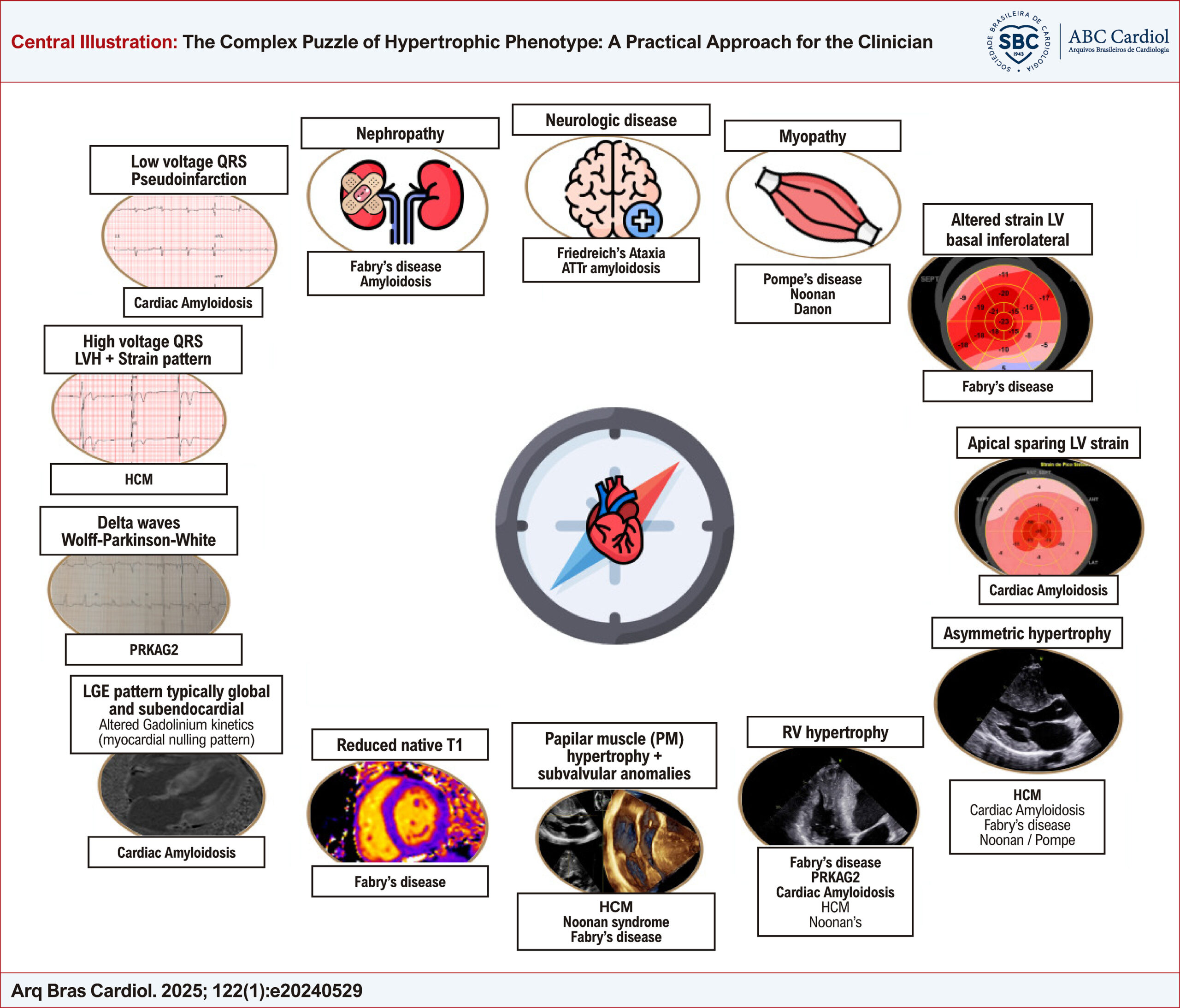 The Complex Puzzle of Hypertrophic Phenotype: A Practical Approach for the Clinician