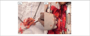 Figura 3