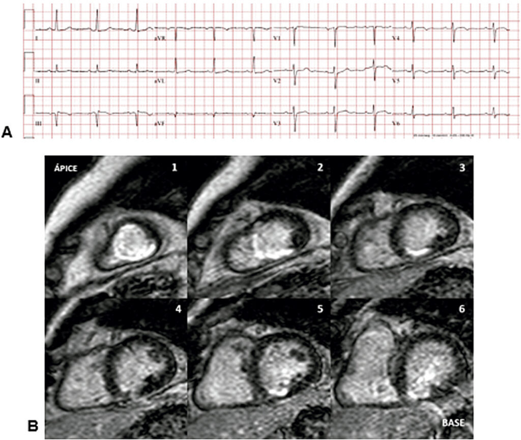 Figure 6