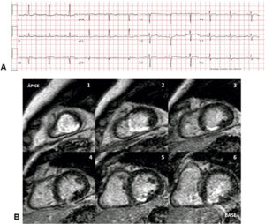 Figure 6