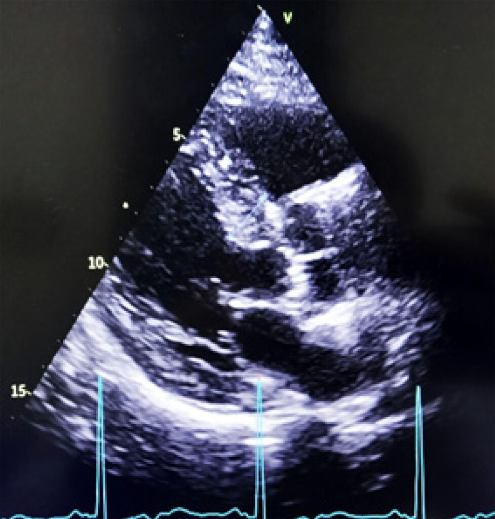 Figure 5