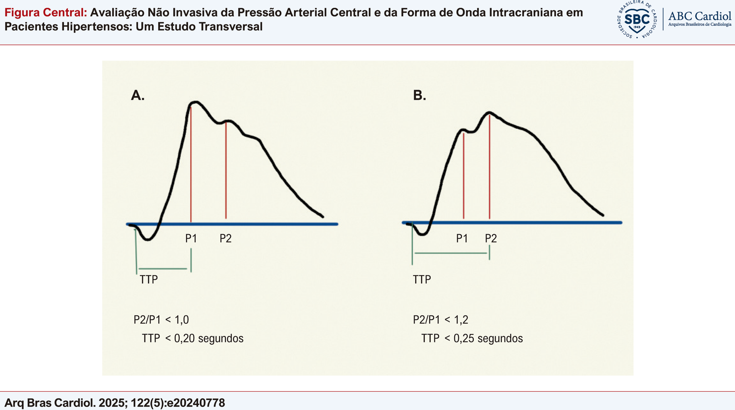 Avaliação Não Invasiva da Pressão Arterial Central e da Forma de Onda Intracraniana em Pacientes Hipertensos: Um Estudo Transversal