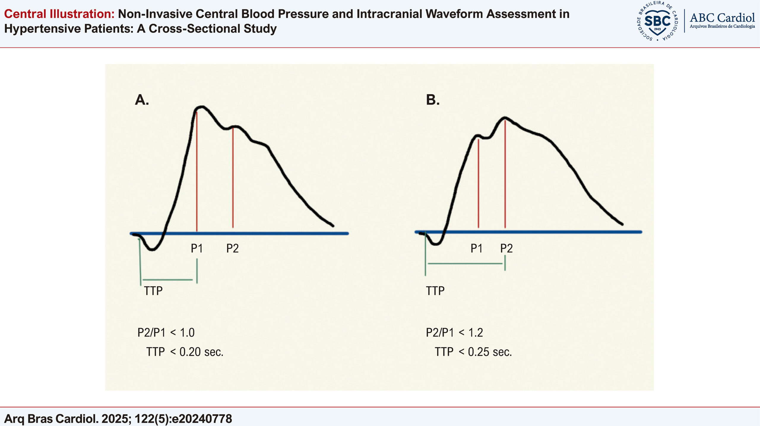 Non-Invasive Central Blood Pressure and Intracranial Waveform Assessment in Hypertensive Patients: A Cross-Sectional Study