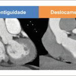 Figura 1
