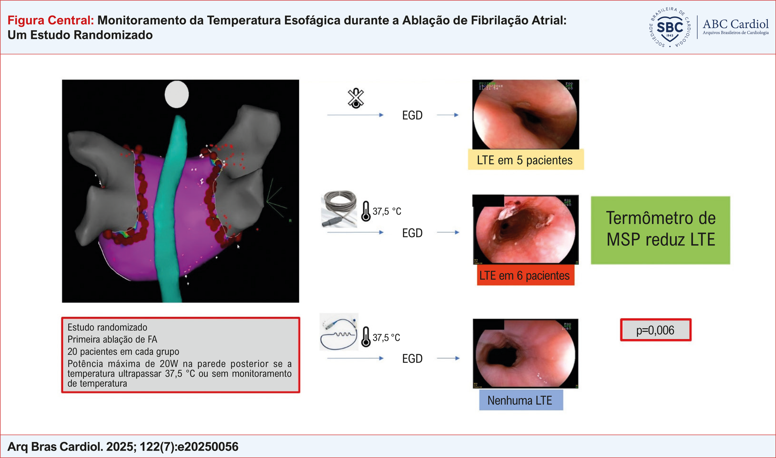 Monitoramento da Temperatura Esofágica durante a Ablação de Fibrilação Atrial: Um Estudo Randomizado