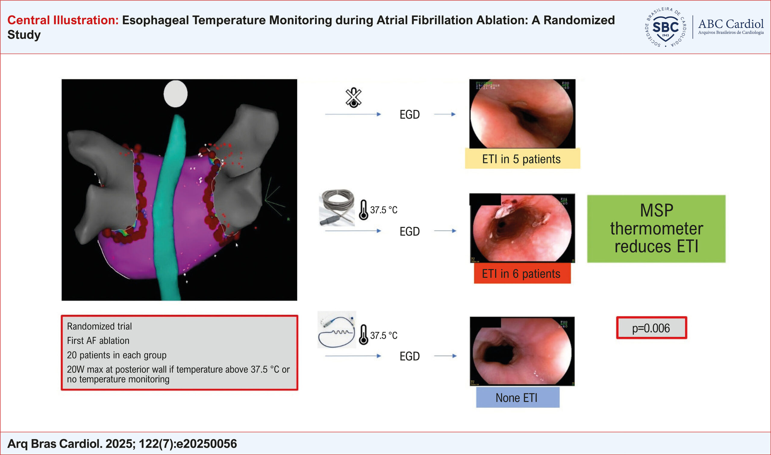 Esophageal Temperature Monitoring during Atrial Fibrillation Ablation: A Randomized Study