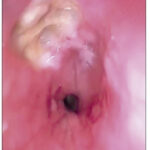 Figura 1