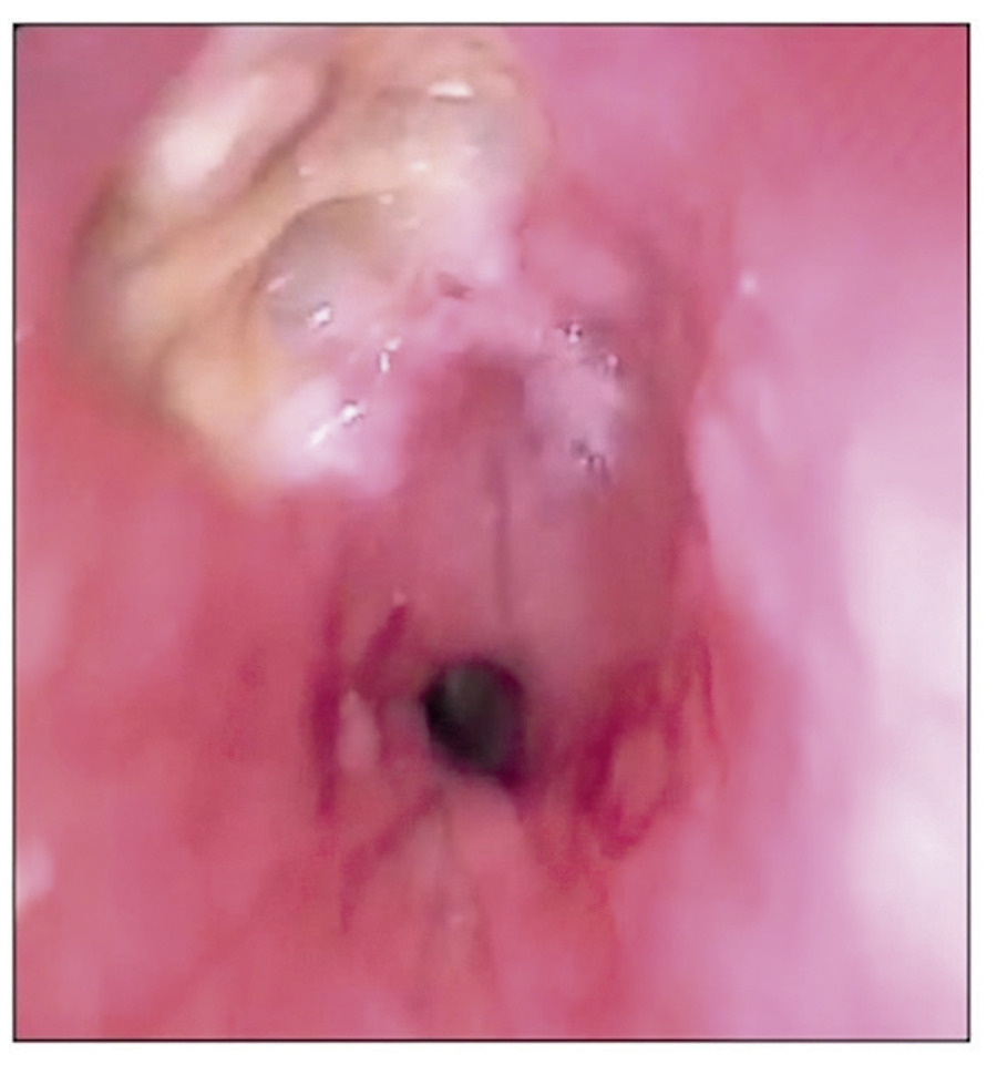 Figura 1