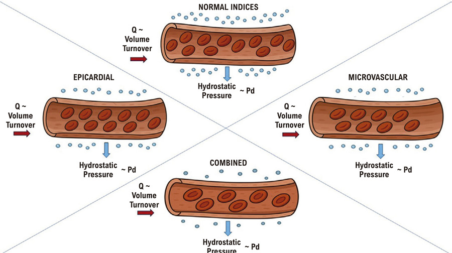 Physiological Characterization of Coronary Endotypes: Potential Links with Myocardial Ischemia