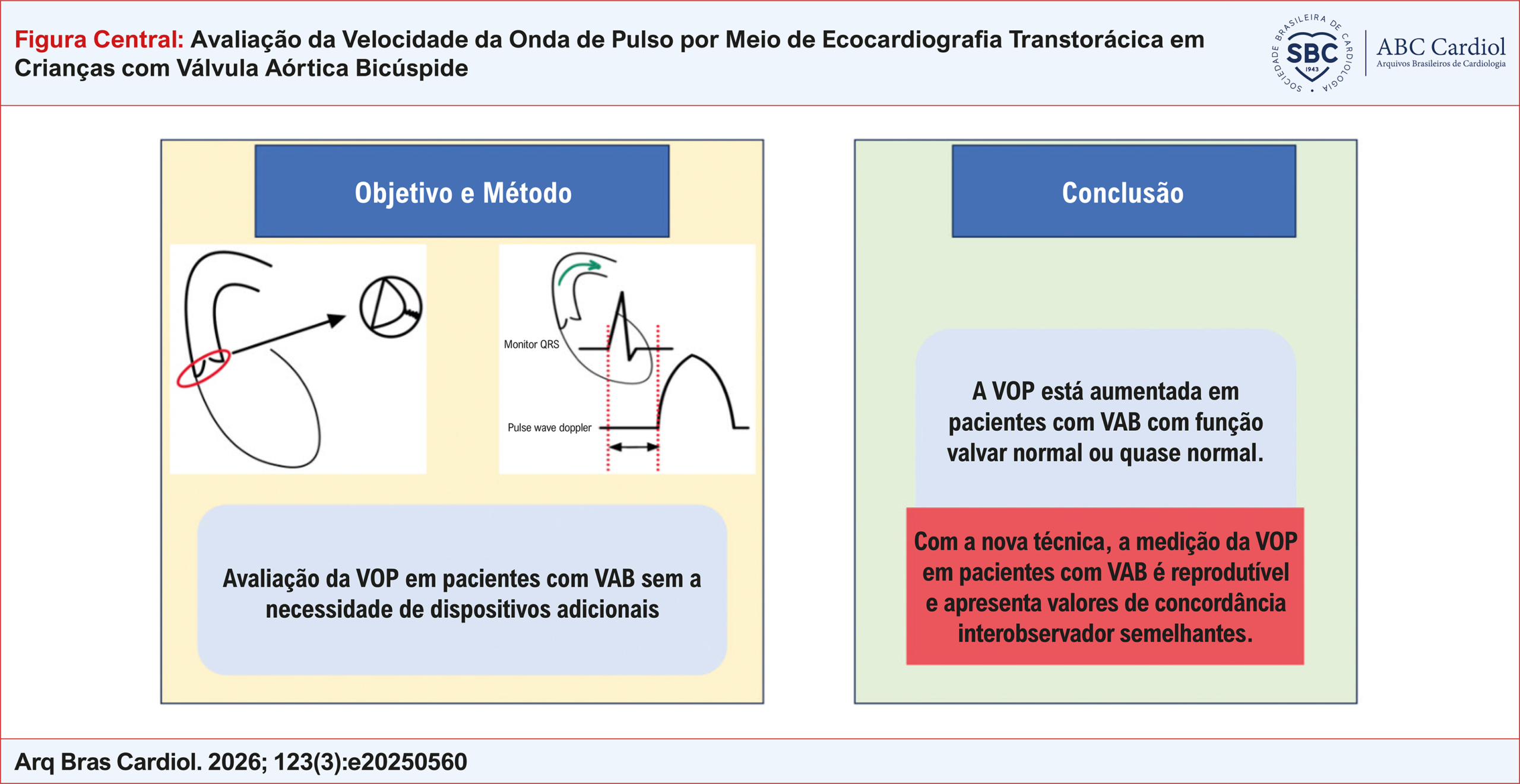 Avaliação da Velocidade da Onda de Pulso por Meio de Ecocardiografia Transtorácica em Crianças com Válvula Aórtica Bicúspide