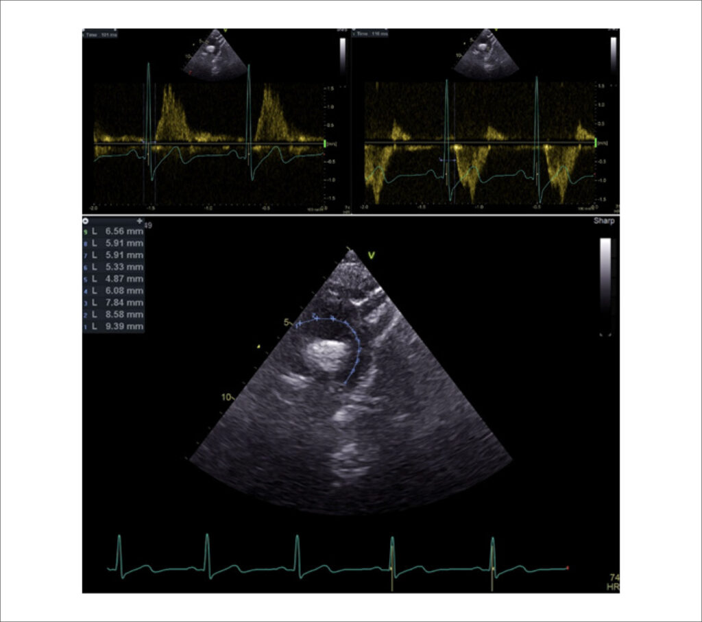 Figure 2