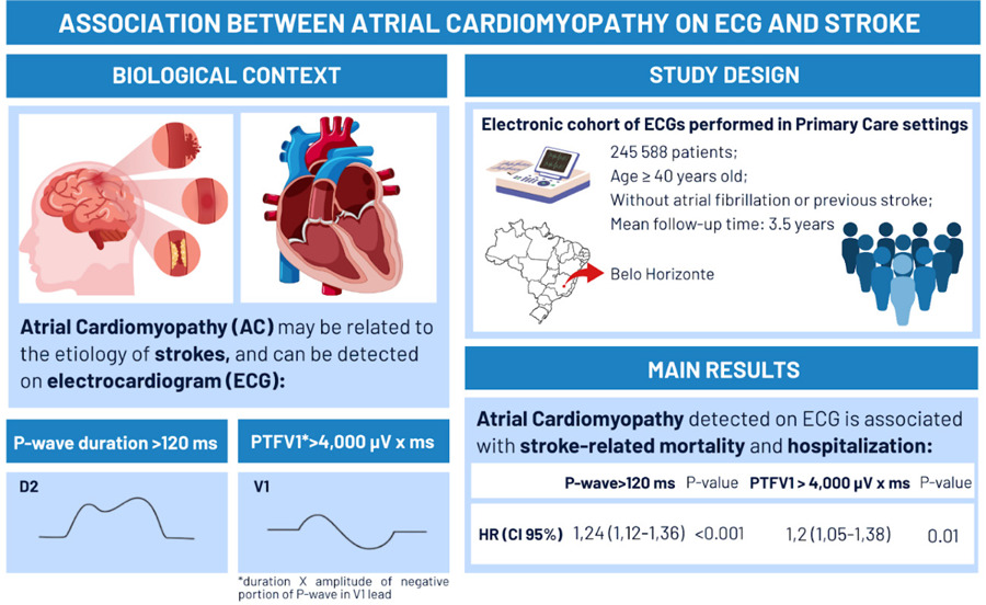 Atrial Cardiomyopathy Detected by Electrocardiogram: Association with Stroke in a Brazilian Electronic Cohort