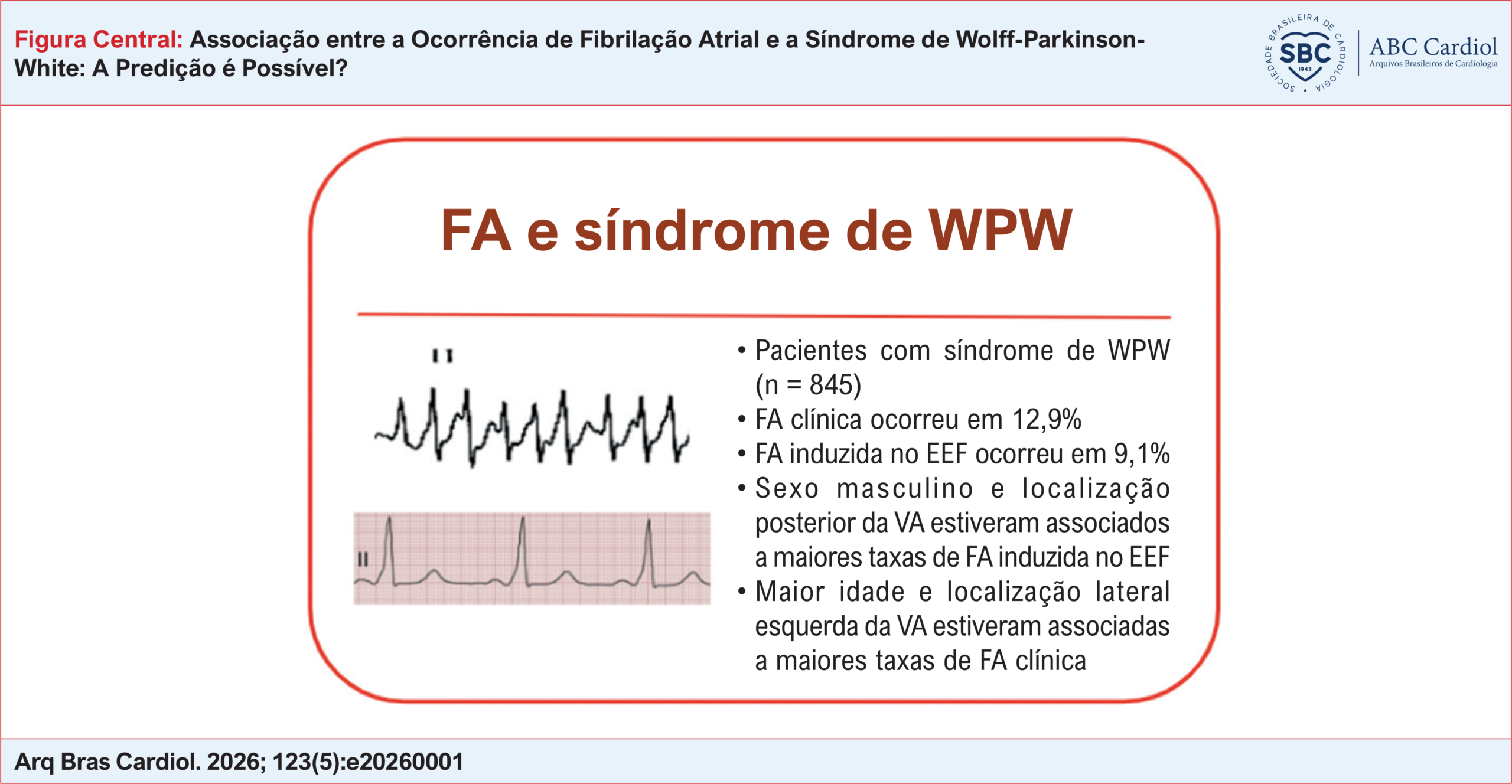 Associação entre a Ocorrência de Fibrilação Atrial e a Síndrome de Wolff-Parkinson-White: A Predição é Possível?