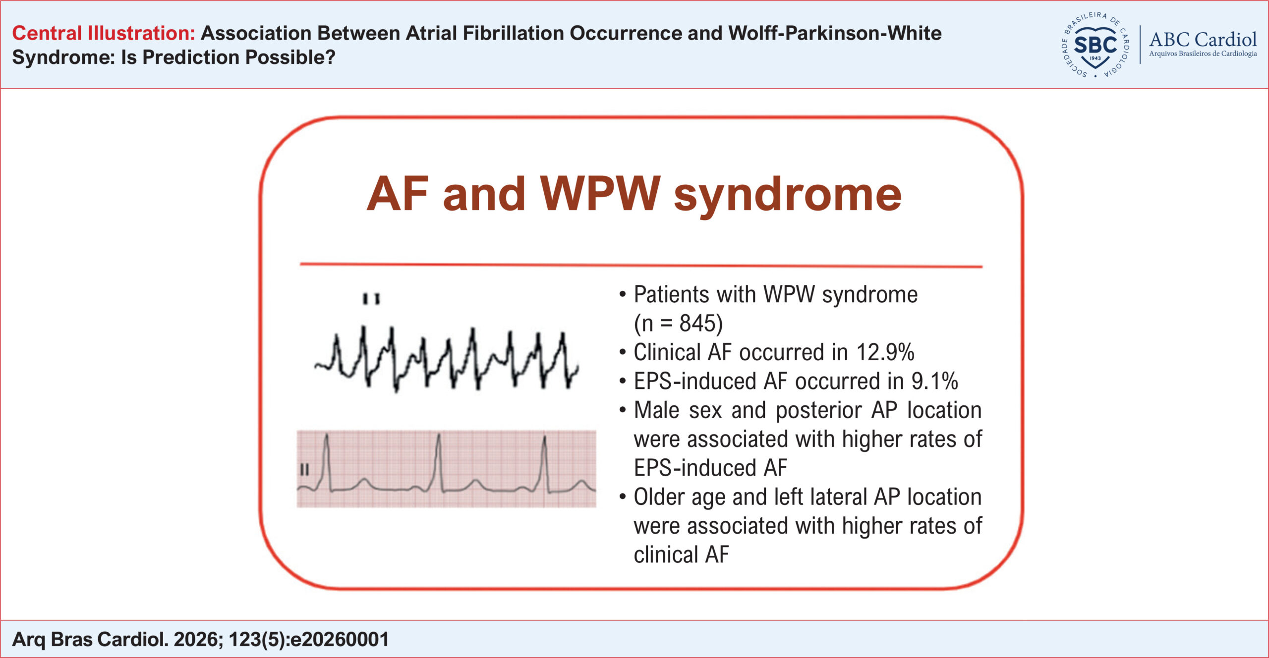 Association Between Atrial Fibrillation Occurrence and Wolff-Parkinson-White Syndrome: Is Prediction Possible?