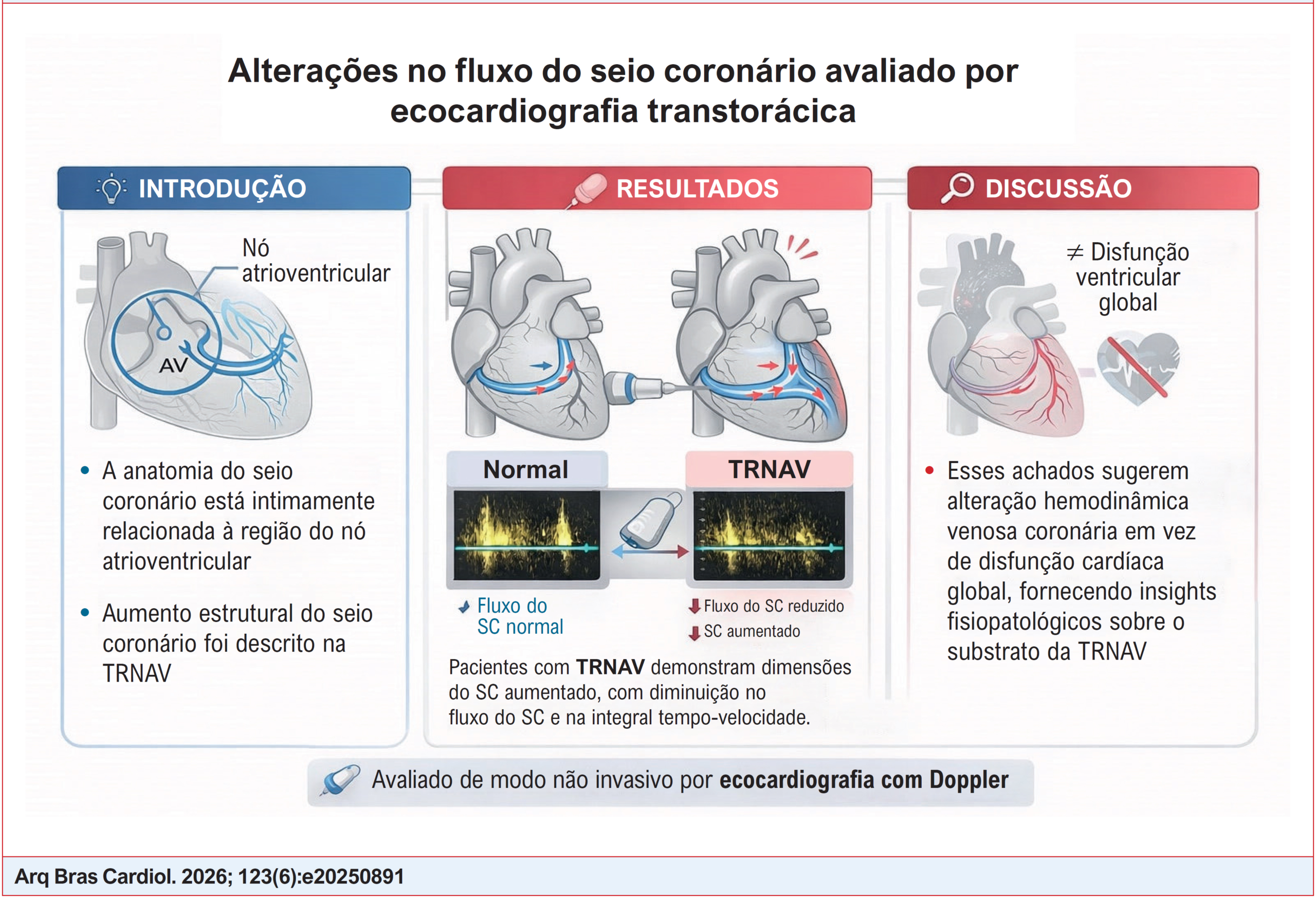 Avaliação do Fluxo e das Dimensões do Seio Coronário por Ecocardiografia Transtorácica em Pacientes com Taquicardia por Reentrada Nodal Atrioventricular
