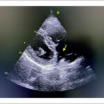 Figura 1