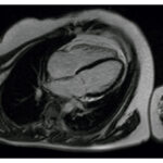 Figura 2