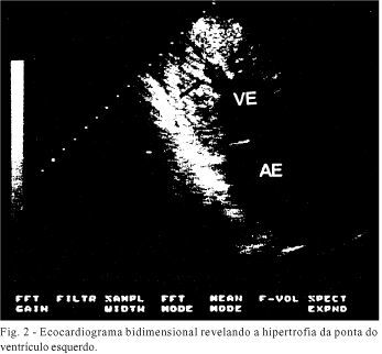 Imagem 2 da galeria