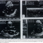 Imagem 2 da galeria