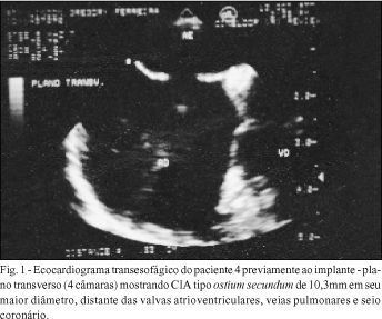 Experiência inicial no fechamento percutâneo da comunicação interatrial com a prótese de Amplatzer