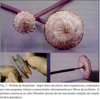 Imagem 2 da galeria