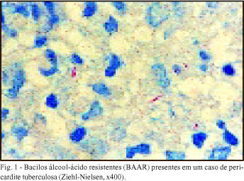 Imagem 1 da galeria